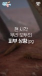 [스브스뉴스] 화장하고 나면 가려워…현 시각 우리 피부 상황은