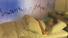 수면무호흡증 치료 부담 줄어든다…양압기 대여료 건보 적용