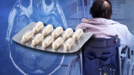 방향 트는 치매 치료…염증 조절 신약 임상시험