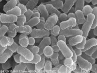 비소…치명적 독성 줄이는 박테리아 발견