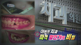 66만 원으로 교정? ‘이벤트 치과’의 두 얼굴
