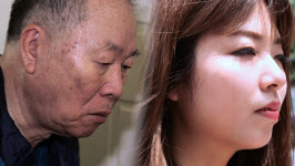 지나치게 많이 흐르는 땀…병일까?