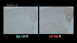 “푹 자봤으면 소원이 없겠어”…수면부족 뇌의 ‘경고’