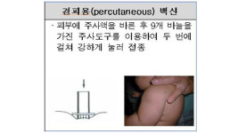 식약처, ‘비소 검출’ 일본 도장형 결핵 백신 회수