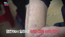 “7년간 소금 독(毒), 돈은 못 받아”…또 ‘염전 노예?’