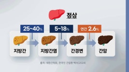 지방간은 술 때문? 그보다 더 큰 원인 있다! [건강하십니까]