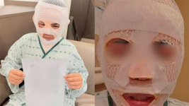 태국인 아내 얼굴에 끓는 물 부은 남편 “실수였다” 주장