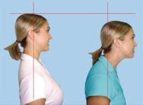 거북목 증후군 예방법, 예쁜 목라인 지키고 싶다면…스트레칭과 올바른 자세 필수!