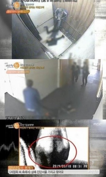 '리얼스토리 눈' 서정희, 서세원의 폭행에 