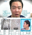 ‘비타민’ ‘탈모왕’ 1위 황현희…걱정 없는 4위는 강균성