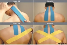 직장인 ‘거북목’ 증후군…스포츠메디컬 테이핑으로 예방