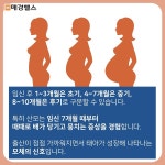 [건강스펀지] 임산부 배뭉침 및 조기진통, 조산 가능성 신호 의심