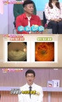 고혈압 높으면 눈에도 중풍 발병…“방치 시 안구제거 위기까지”(엄지의 제왕)