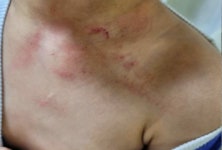 구석에 몰아놓고 권투하듯 무차별 폭행 포항 어린이집 학대 영상