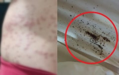 자고 나니 온몸에 두드러기가...서울 모텔 침대서 벌레 무더기 확인