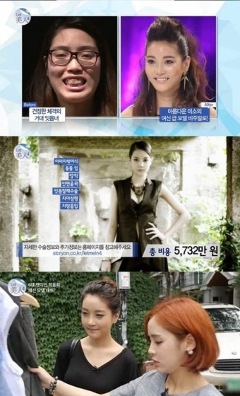 '렛미인' 박동희, 여자 최홍만→패션 모델로 변신 '너무 예뻐졌다'