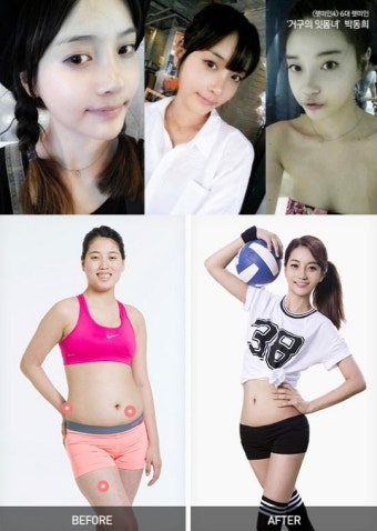 '렛미인' 거구의 잇몸녀, 변신 전 후 사진 보니 '믿을 수 없어'