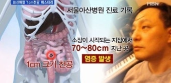 故 신해철 부검 결과, 