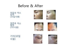 피부노화 방지 효험 미백 화장품 피토라이저 개발, 피부과 전문의 임재영 원장