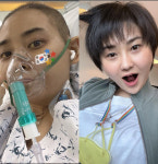 윤주, 간이식 수술 후…머리카락이 자란다 건강한 미소