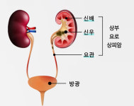 췌장암 진단 지표 CA19-9 높으면 상부요로상피암 재발·사망 위험 증가