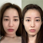 유깻잎, 붓기 전후 민낯 이렇게 달라? 가감없는 얼굴 공개