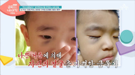 얼굴에 가득한 멍 아동학대 금쪽이, 유치원 8번 옮긴 트라우마 극복 [종합](금쪽같은 내새끼)