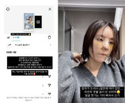 돌싱 이소라, 가슴→코 성형 고백 후 근황 얼굴 부기 거의 빠져서 신기