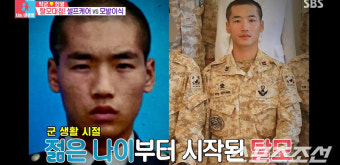 한영, '탈모' 박군 생일선물로 '1400만원' 모발 이식 제안. 박군은 맞춤제작 가발 가게로…(동상이몽)