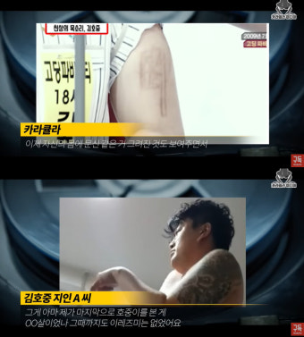김호중, 학폭 의혹..“센 척하려 이레즈미..아무 사람 뺨 때려. 인성 안 좋았다”