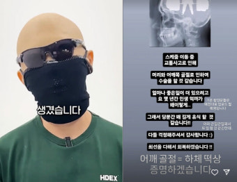 김계란, 교통사고로 머리·어깨 골절…