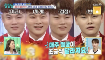 박서진, 성형수술에 1억 
