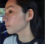 연정훈♥ 한가인, 컨디션 난조 호소..결국 이혈 테라피 받았다