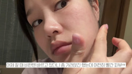 둘째 임신 헤이지니, 해외서 급격히 나빠진 상태 충격적