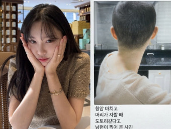 '암투병' 이솔이, 항암 후 짧아진 머리+암수술 당시 공개 