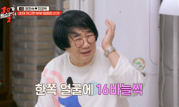 63세 최양락, 눈 2번 수술+안면거상에 확 바뀐 얼굴 페이스오프 했다 (1호가)[종합]