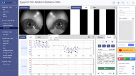 뉴로이어즈, 세계 최초 VR 기반 어지럼증 진단 의료기기 뉴로이어즈 안나 美 FDA 승인