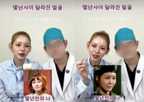 의사 남친에 시술 받은 맹승지, 몇년 사이 달라진 얼굴 해명 