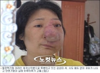 은미 씨의 잃어버린 얼굴 옛날로 돌아갈 수 있다면…