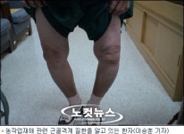 노동에 농약에 중독되는 농민들, 근골격계 질환에 신음