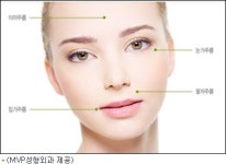 성형전문의가 말하는 동안의 조건