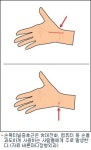 손저림 심하면 손목터널증후군 의심