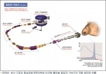 꿈의 암 치료기 저소득층, 기장군민 혜택본다