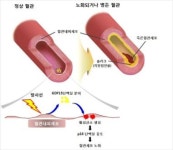 방사선 치료 걱정없이 받으세요