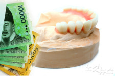 비싼 틀니·임플란트…이젠 옛말?