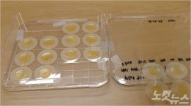 세계 최초 의료용 마이크로 니들 상용화 기업 (주)에스엔비아