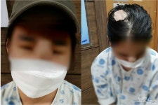 여고생 코 뜯긴 아파트 공사장 옆 공포의 하굣길