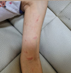 포항 근로복지공단 어린이집 교사, 6살 원생 지속 폭행…은폐 의혹