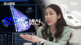 살찌고 여드름 나는 게 난소 때문? 여성에게 흔한 다낭성난소증후군[의사결정]