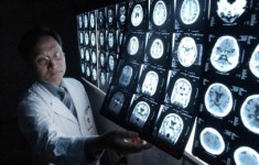 [Weekly Health Issue] 치매